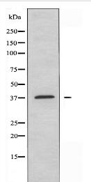 HOXB2 Antibody