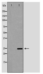 PYCARD Antibody