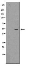 PDK4 Antibody
