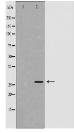 NGF Antibody