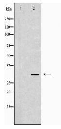 IGFBP5 Antibody