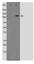 TERT Antibody