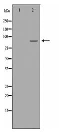 RRM1 Antibody