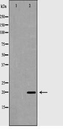 PARK7 Antibody