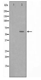 KCNC1 Antibody