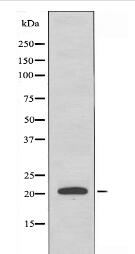 RAB31 Antibody