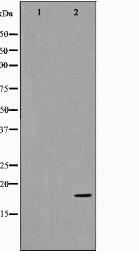 p18 INK Antibody