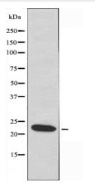MRPL40 Antibody