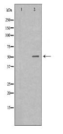 IL-6R Antibody