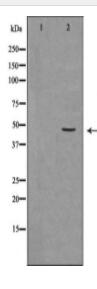 LAMP2 Antibody