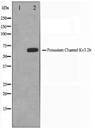 KCNC2 Antibody