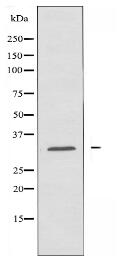 OR10J6 Antibody