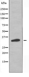 OR4F4/4F5/4F17 Antibody