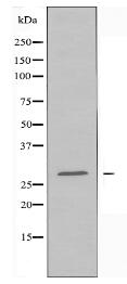 HOXA11/D11 Antibody
