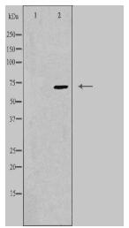 PPP2R3B Antibody