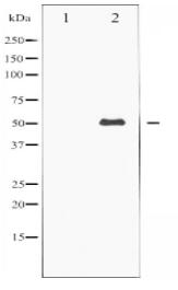 Keratin 8 Antibody