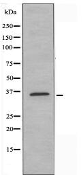 OR52A5 Antibody