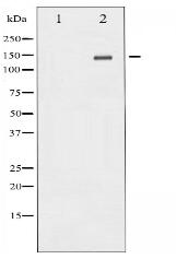 Met Antibody