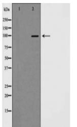 HDAC7 Antibody