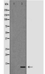 S100A12 Antibody