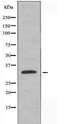 OR2F2 Antibody