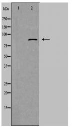 ZFYVE20 Antibody