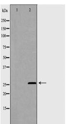 PSMB1 Antibody