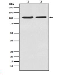 HIF-2 alpha Antibody