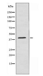 RRS1 Antibody