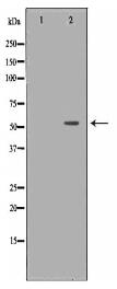 IRF5 Antibody