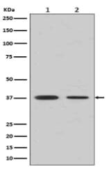 Liver Arginase Antibody