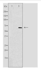 TIGD1 Antibody