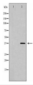 KIR2DL3 Antibody