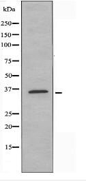 OR10R2 Antibody