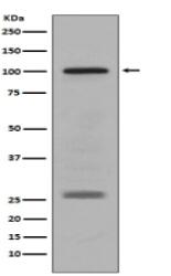 PMEL17 / GP100 Antibody