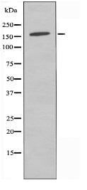 RAB3GAP2 Antibody