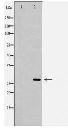 HOXC8 Antibody