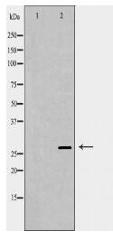 PSMB5 Antibody