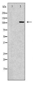 RPGR Antibody