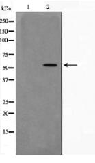 AKT1 Antibody