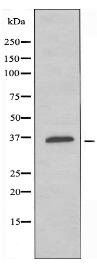 OR4K14 Antibody