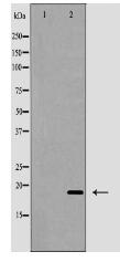 Interferon gamma Antibody