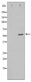 RBBP5 Antibody