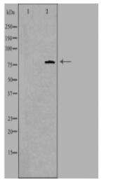 MTA1 Antibody