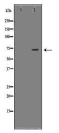 LCP1 Antibody