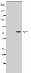 PPHLN Antibody