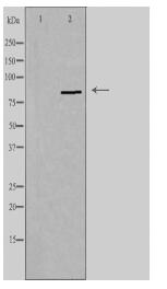 PNPLA8 Antibody