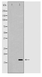 RNASE12 Antibody