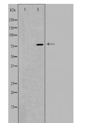 PIP5K1C Antibody