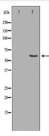 KCNQ1 Antibody